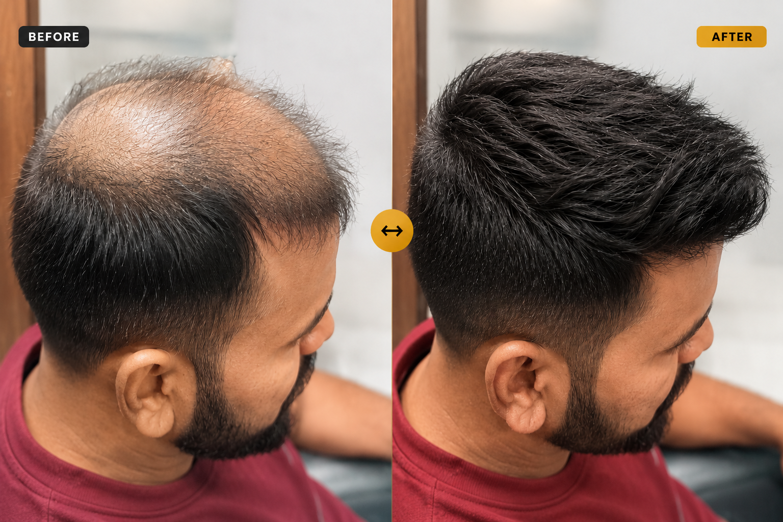 Before and after hair patch transformation — Premium Hair Patch — Styled & Blended